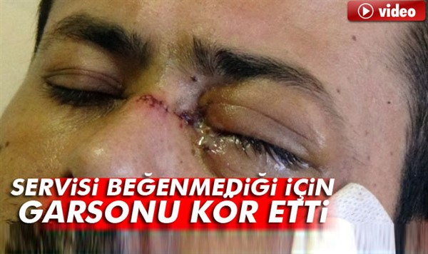 Adıyaman'da servisi beğenmediği için garsonu kör etti