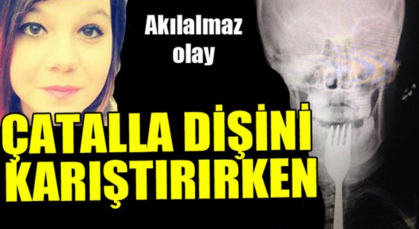 Dişini karıştırdığı çatal...