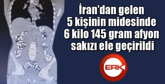 İran’dan gelen 5 kişinin midesinde 6 kilo 145 gram afyon sakızı ele geçirildi