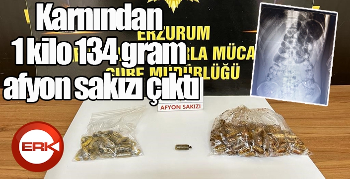 Karnından 1 kio 134 gram afyon sakızı çıktı