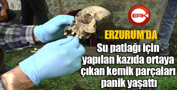 Su patlağı için yapılan kazıda ortaya çıkan kemik parçaları panik yaşattı